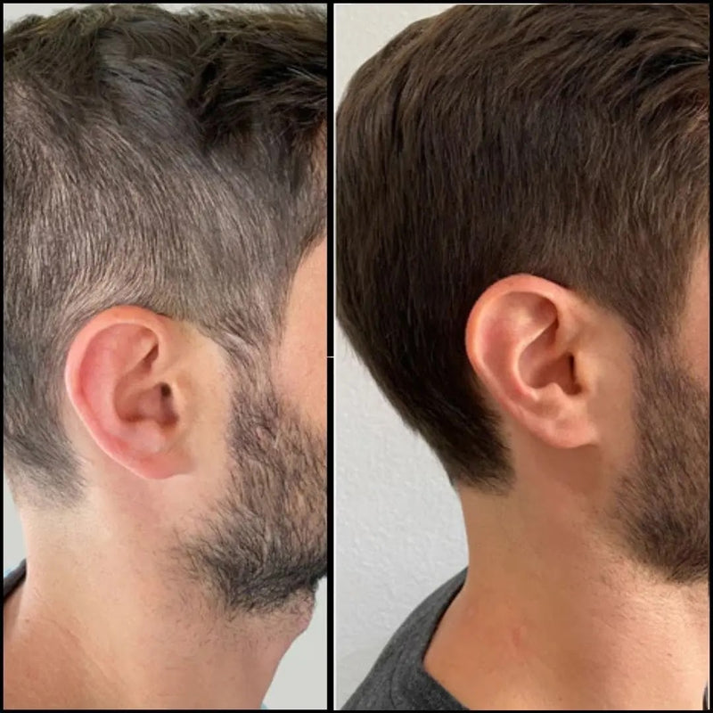 🔥 ¡ÚLTIMAS UNIDADES! Shampoo Cubre Canas + Colágeno de Obsequio ¡GRATIS! 🔥
