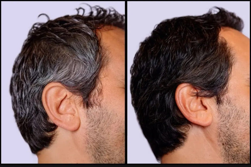 🔥 ¡ÚLTIMAS UNIDADES! Shampoo Cubre Canas + Colágeno de Obsequio ¡GRATIS! 🔥