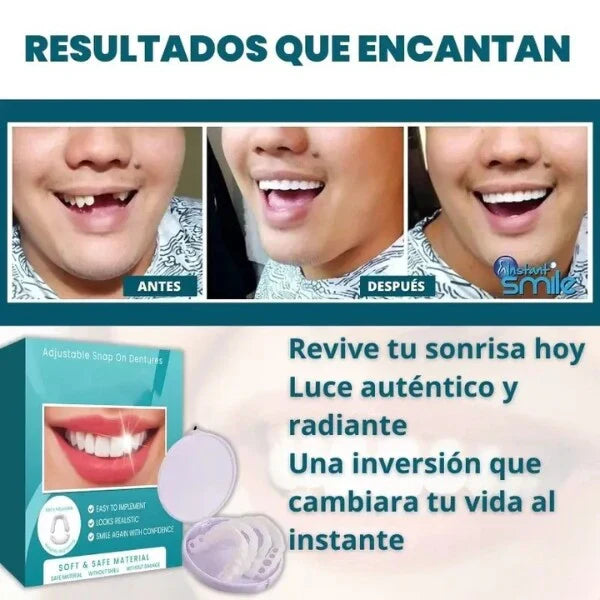 ¡TRANSFORMA TU SONRISA HOY! CARILLAS DENTALES INFERIORES Y SUPERIORES