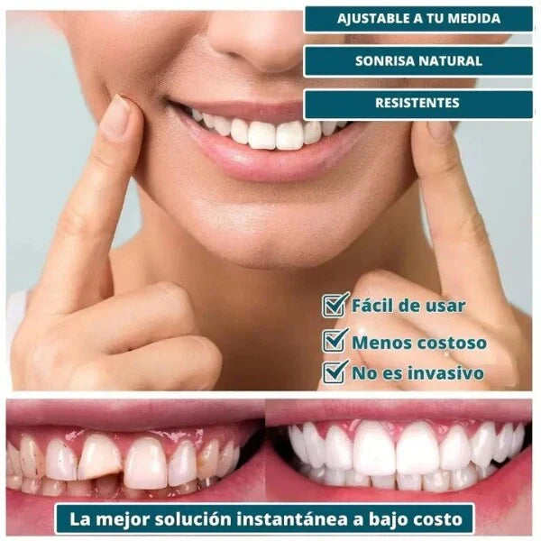 ¡TRANSFORMA TU SONRISA HOY! CARILLAS DENTALES INFERIORES Y SUPERIORES
